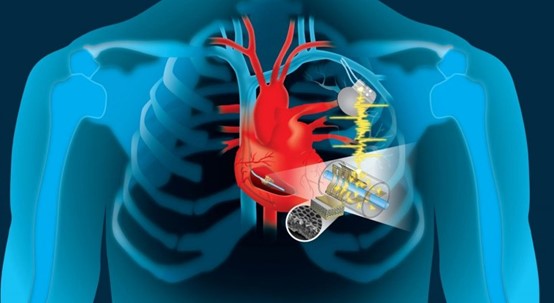 GSdednc无需澳门十大娱乐网站是多少更换心脏起搏器电池可植入医疗设备的供电公